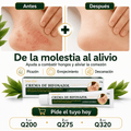 Bifonazol Skin Relief - Alivio y cuidado frente a molestias causadas por hongos. - AURÈNE
