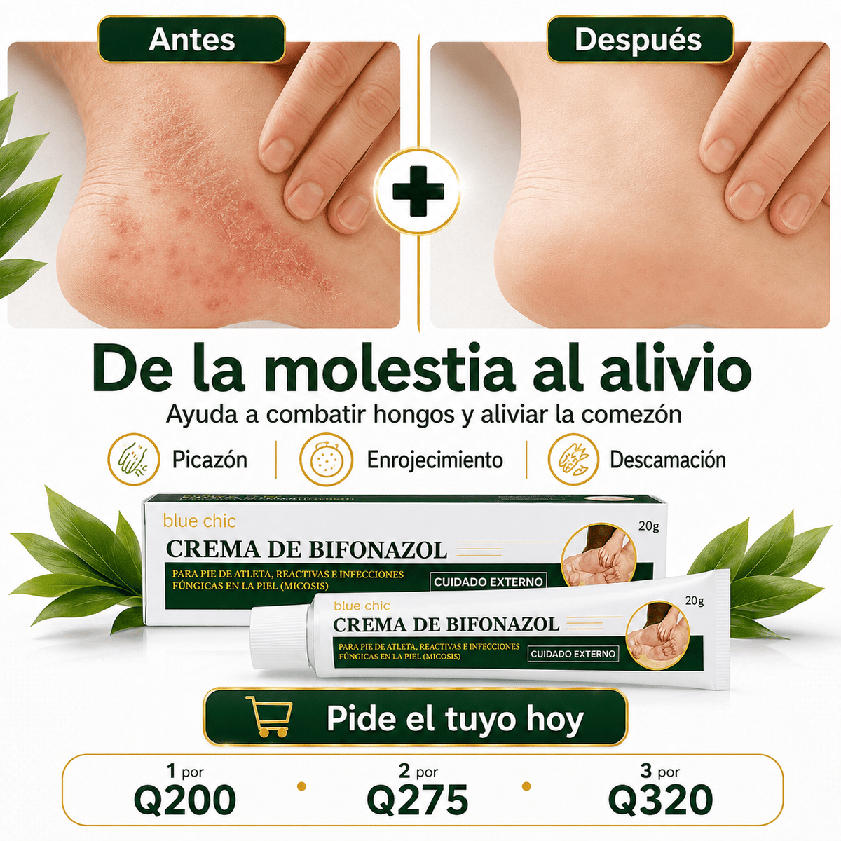 Bifonazol Skin Relief - Alivio y cuidado frente a molestias causadas por hongos. - AURÈNE