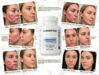 MindBodySkin La Formula 1 para combatir el ACNE hormonal - AURÈNE